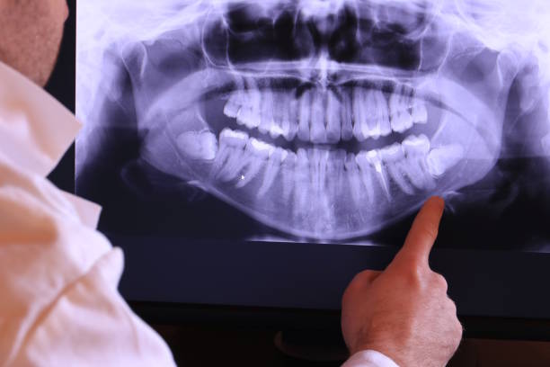 Best Emergency Gum Pain Relief  in Roscoe, TX